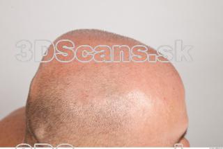 Hair texture of Dale 0003